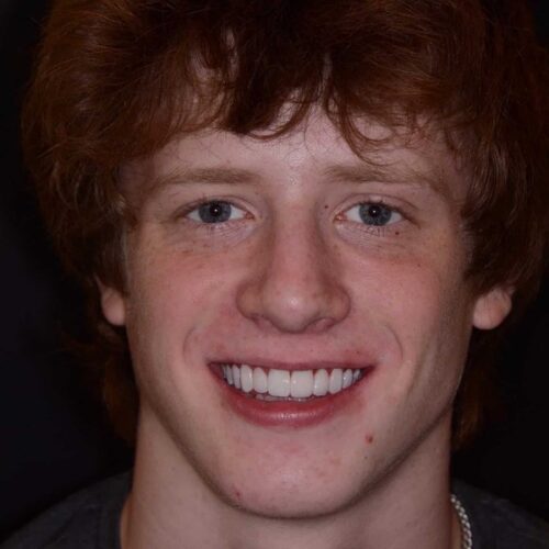 Close-up of a smiling young man with red hair and blue eyes against a dark background.