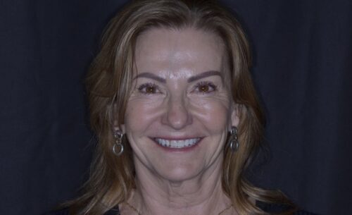 Smiling woman with light brown hair and hoop earrings against a dark background, portrait-style.