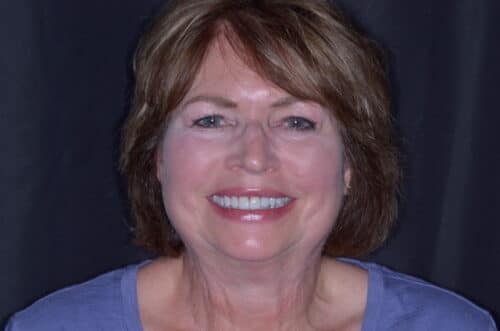 Smiling woman with short brown hair and blue eyes wearing a purple top, against a dark backdrop.