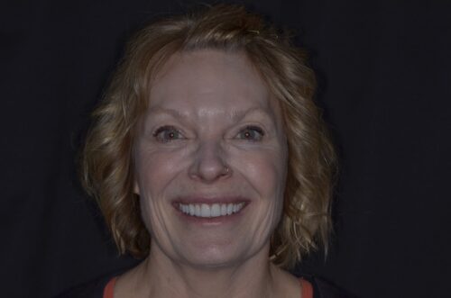 Close-up of a smiling woman with light brown hair against a dark background.