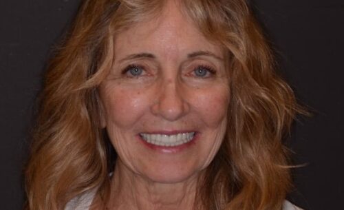 Smiling middle-aged woman with wavy light brown hair against a dark background, showing teeth in a friendly expression.