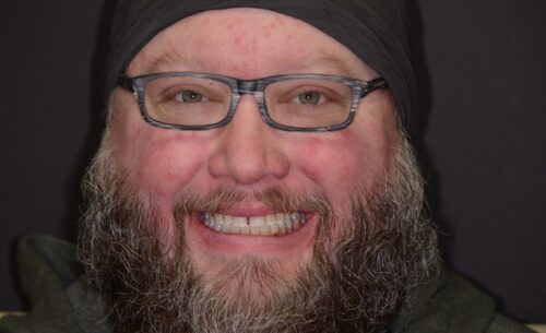 Close-up of a smiling man with glasses, a full beard, and a black headband against a dark background.