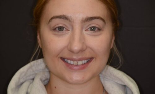 Close-up portrait of a smiling woman with light brown hair wearing a gray hoodie against a dark background.
