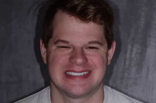 Close-up of a man smiling with eyes nearly closed, showing teeth against a dark backdrop.