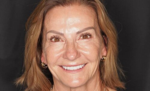 Close-up of a smiling middle-aged woman with light brown hair and gold hoop earrings against a dark background.