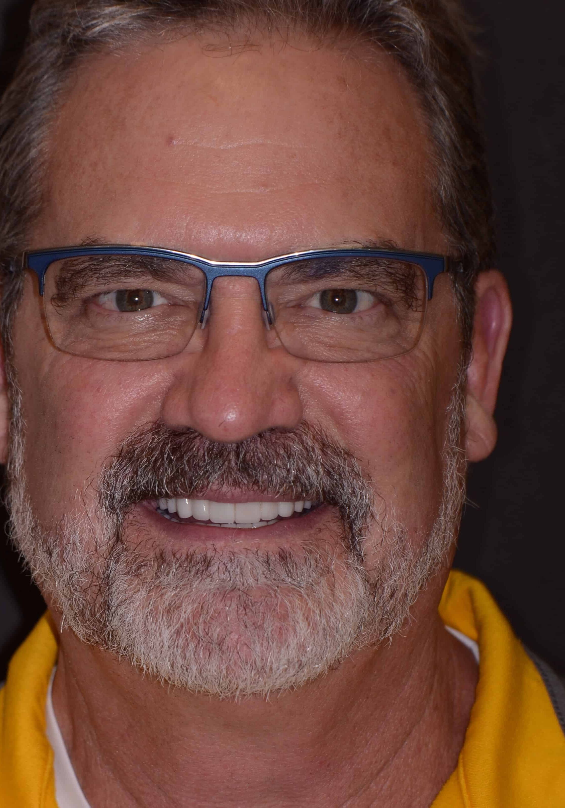 Close-up of a smiling man wearing blue-rimmed glasses and a yellow jacket, showing his mouth and facial hair against a dark background.