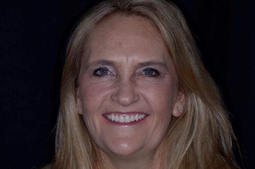 Close-up of a smiling blonde woman with blue eyes against a dark background.